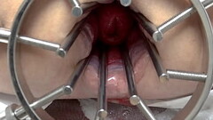 gs2, BDSM Mistress, massive anal speculum, wide open ass, strapon, extreme anal gap Thumb